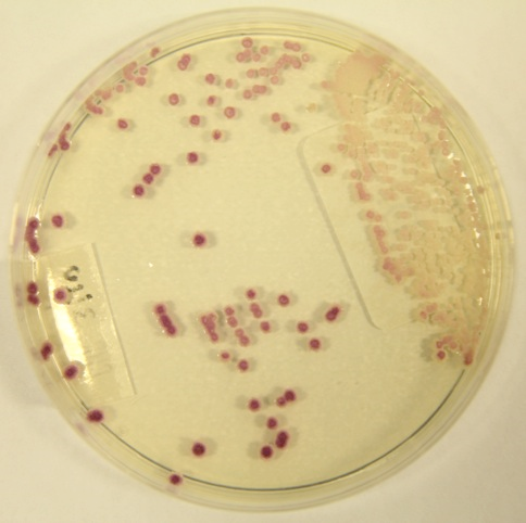 Candida parapsilosis chromagar Candida parapsilosis chromagar