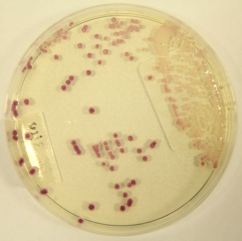 Candida parapsilosis chromagar