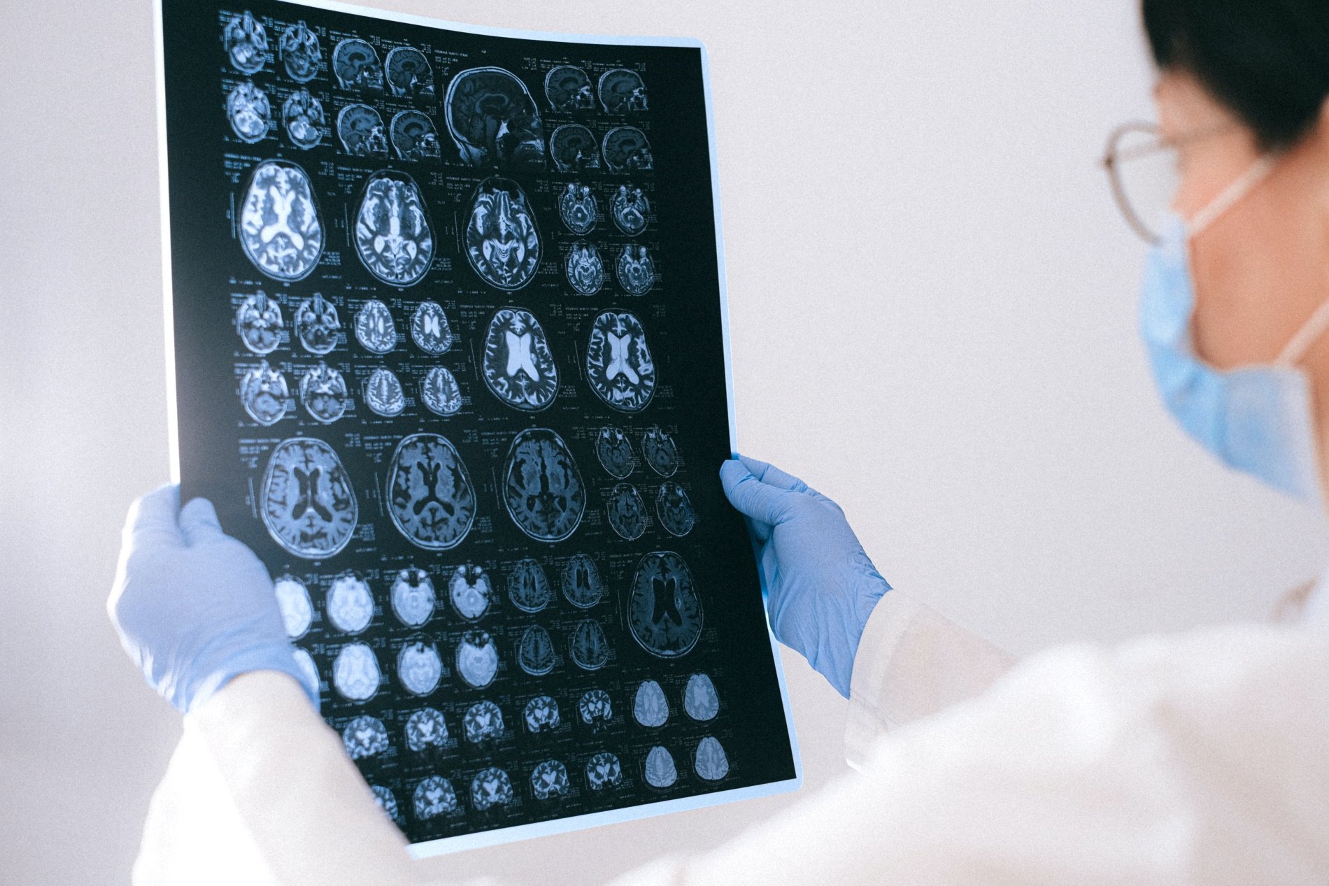 Radiografia Cervell / Pexels