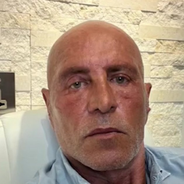 Kiko Matamoros retoque cara Dubai final Instagram Kiko Matamoros retoque cara Dubai final Instagram