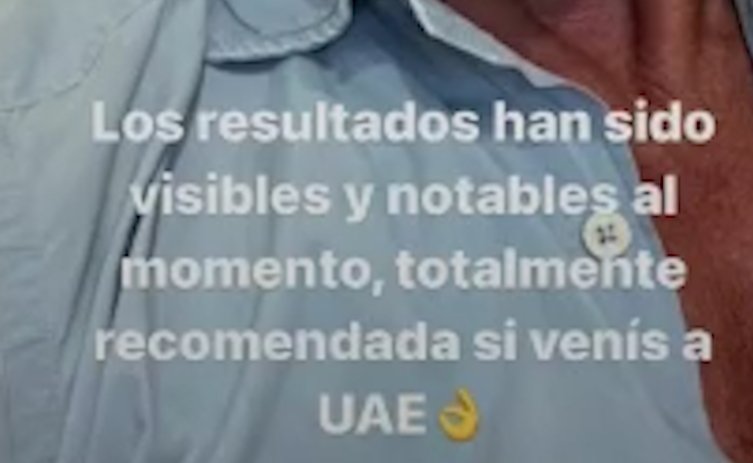 mensaje Kiko Matamoros retoque cara Dubai final Instagram mensaje Kiko Matamoros retoque cara Dubai final Instagram