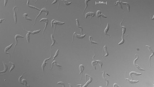 Parásitos causantes de la enfermedad del sueño vistos al microscopio