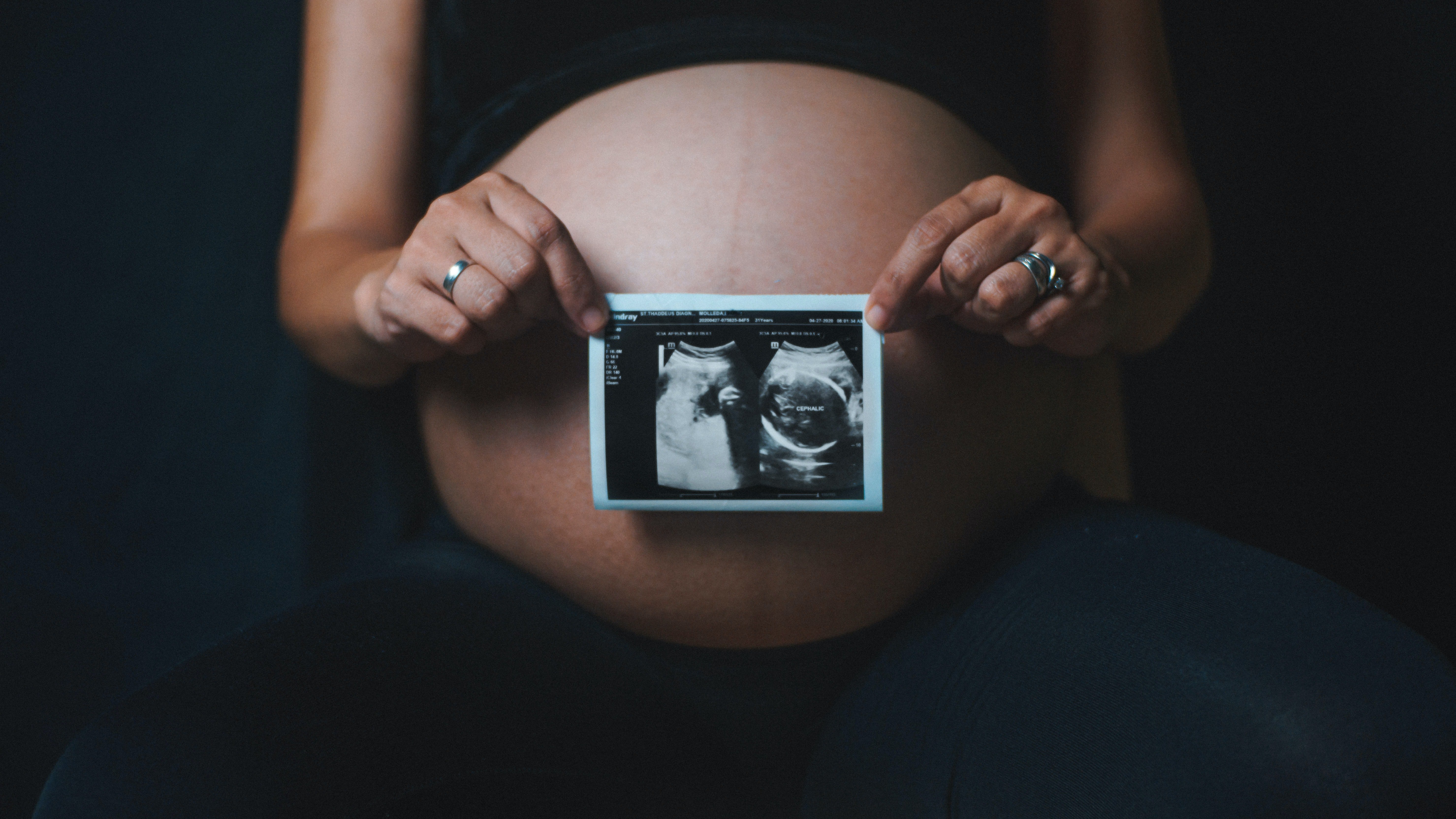 Què és la violència obstètrica i com afecta les dones?