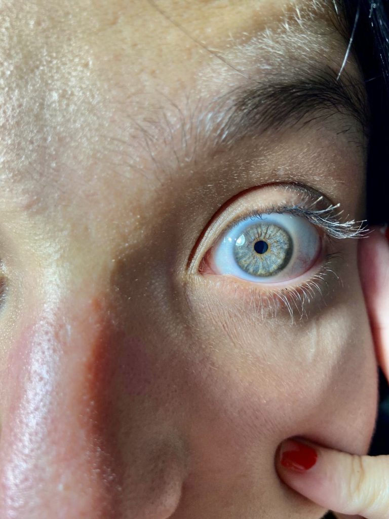 Si vols, pots i, a més, a Barcelona: un làser canvia el teu color d'ulls