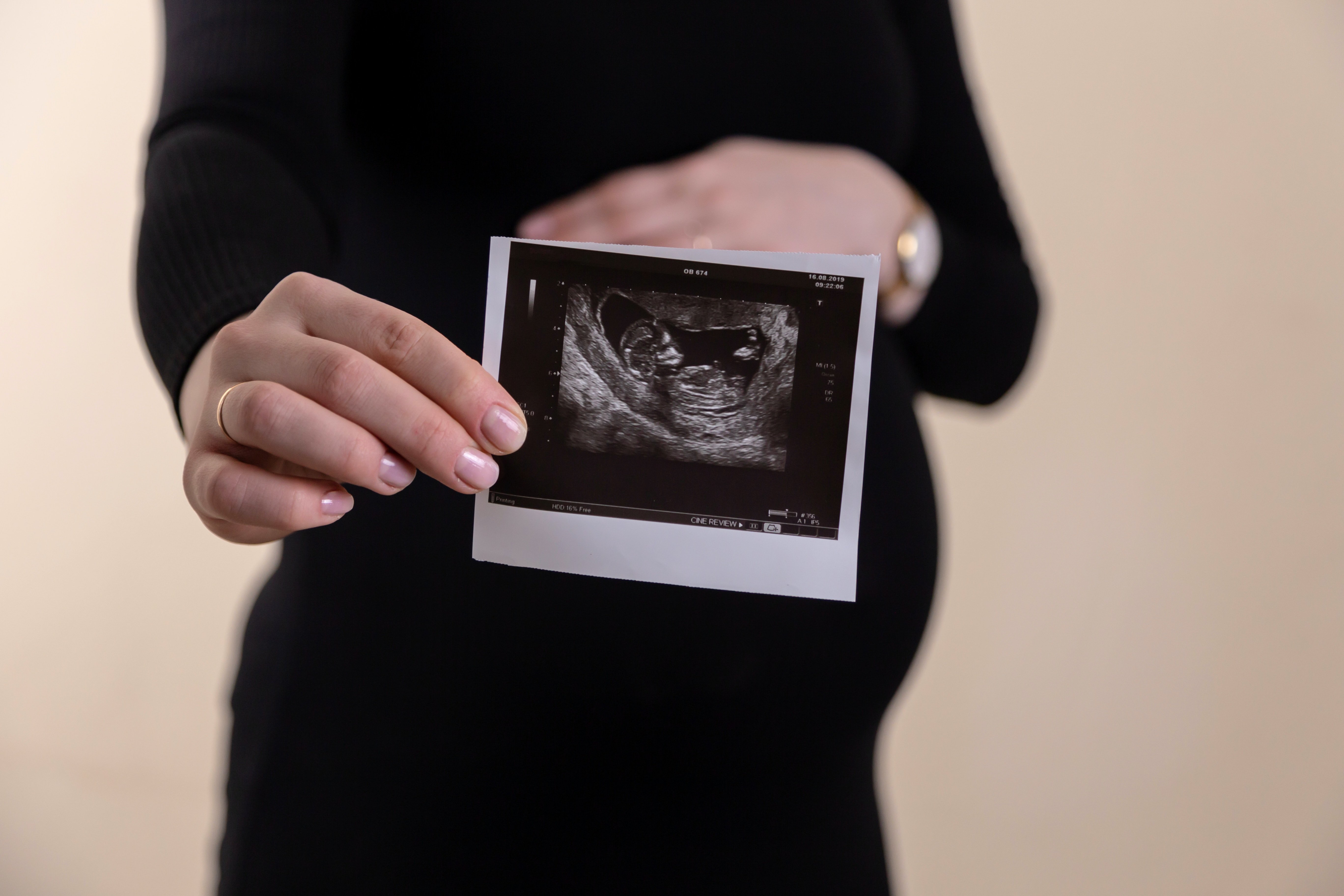 Nueva alerta de la OMS: una de cada seis personas sufre infertilidad