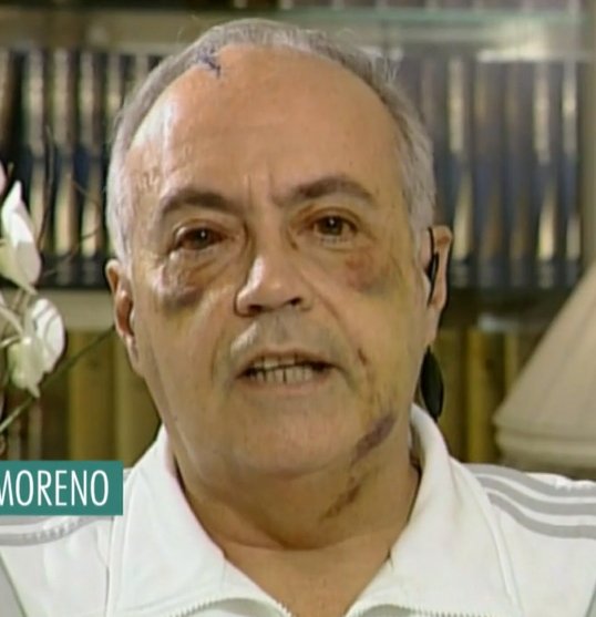 José Luis Moreno paliza ojos 2007 Telecinco