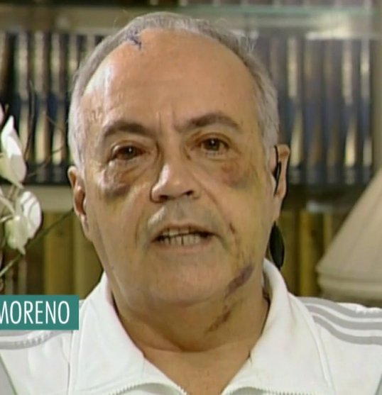 José Luis Moreno paliza ojos 2007 Telecinco José Luis Moreno paliza ojos 2007 Telecinco
