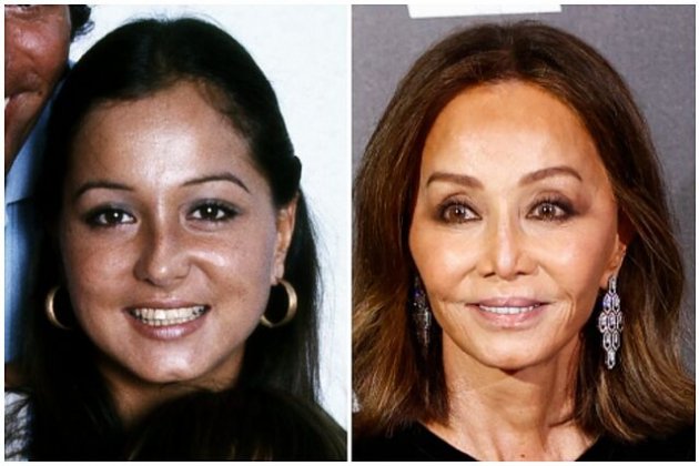 Un cambio muy evidente en la nariz de Isabel Preysler Un cambio muy evidente en la nariz de Isabel Preysler