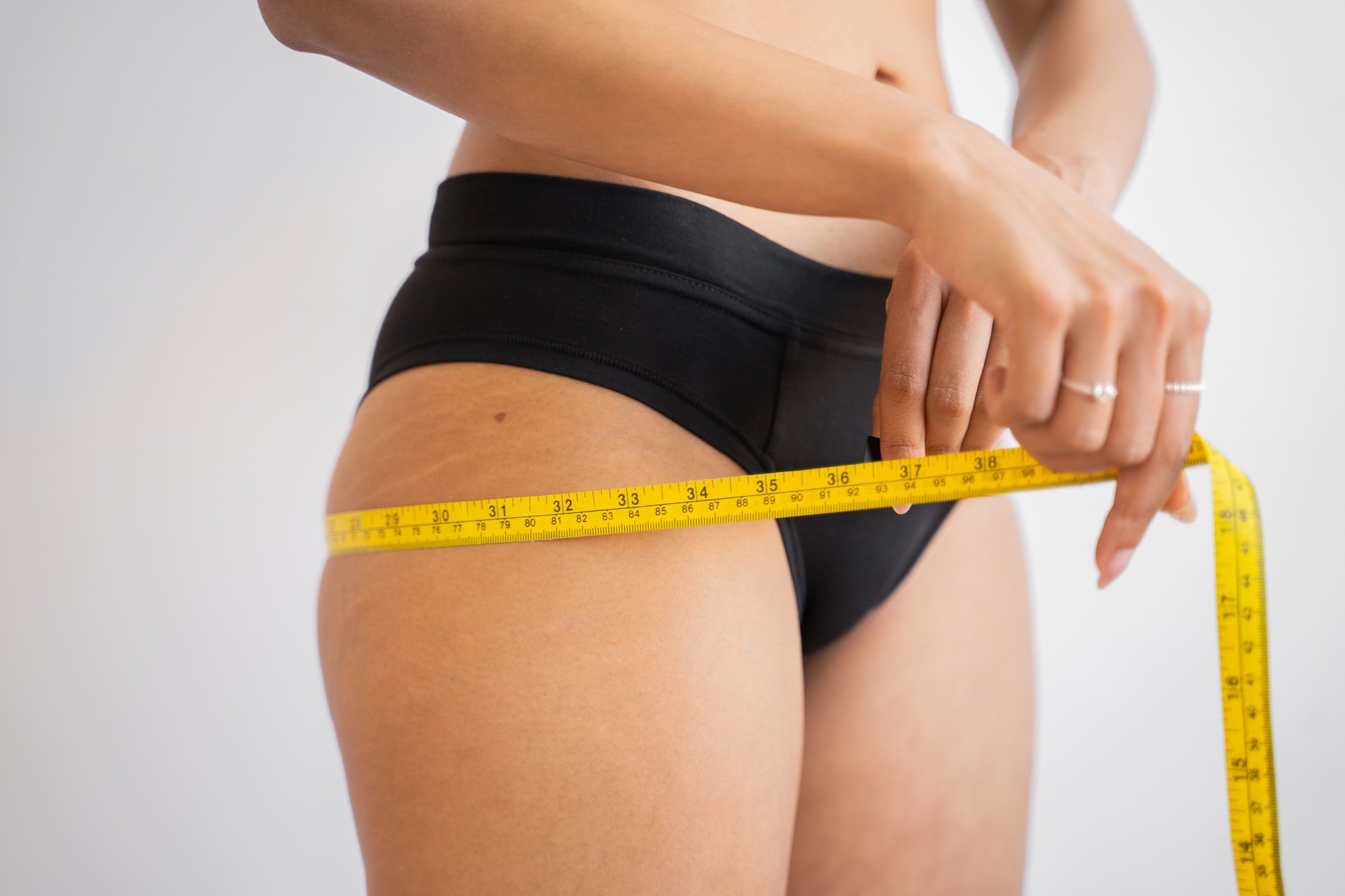 ¿Qué es la celulitis?