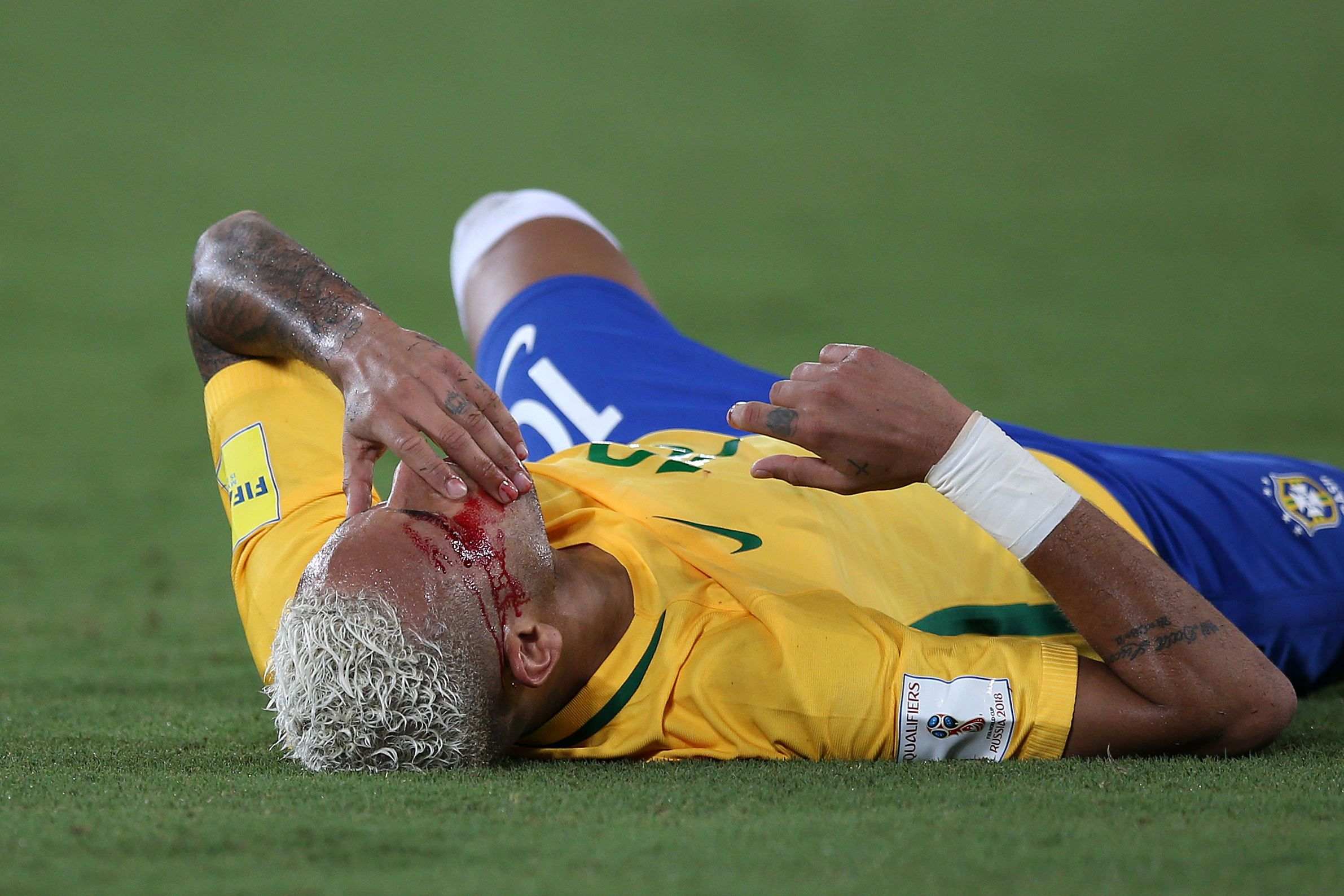 Show de Neymar: marca, asiste y sale sangrando de Natal