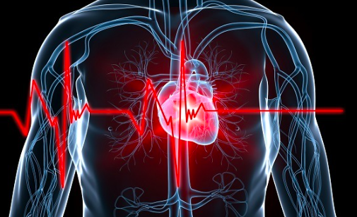 Cardiomiopatia isquemica