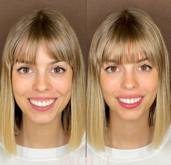 nerea rodriguez abans i despres llavis instagram nerea rodriguez abans i despres llavis instagram
