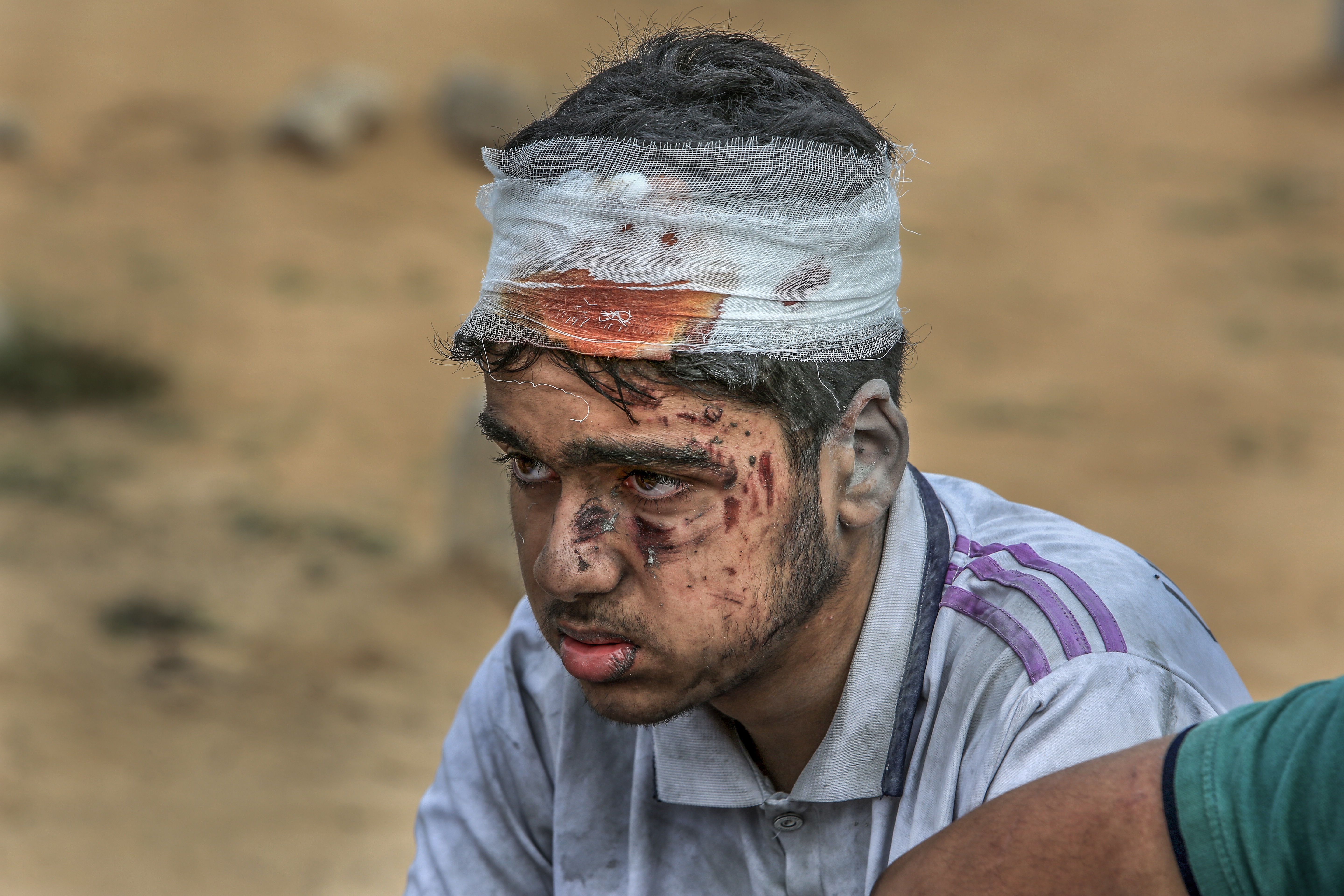 Entran en Gaza el primer equipo médico extranjero y diez camiones con ayuda humanitaria