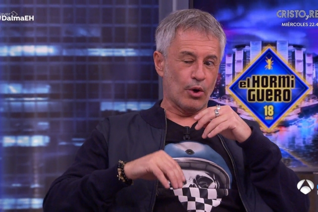 Sergio dalma ojo medio cerrado Antena 3 Sergio dalma ojo medio cerrado Antena 3