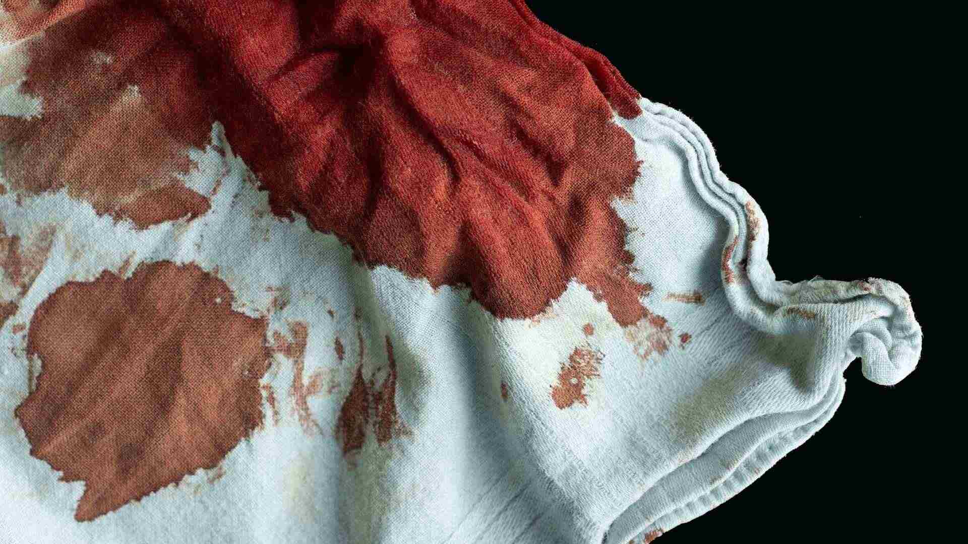 Ara sí: el mètode 100% efectiu per netejar les taques de sang a la roba