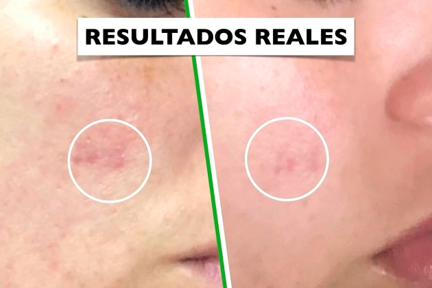 Bio Sérum Facial con Vitamina C, E y Ácido Hyalurónico de la marca Florence Bio Sérum Facial con Vitamina C, E y Ácido Hyalurónico de la marca Florence