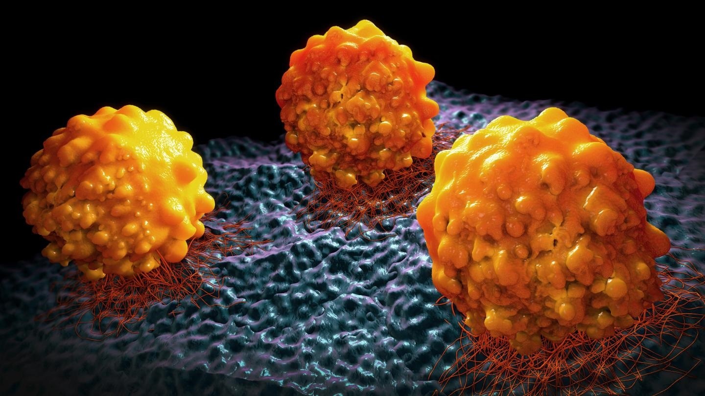 Científicos de los EE.UU. identifican un fármaco prometedor para tratar el cáncer de páncreas