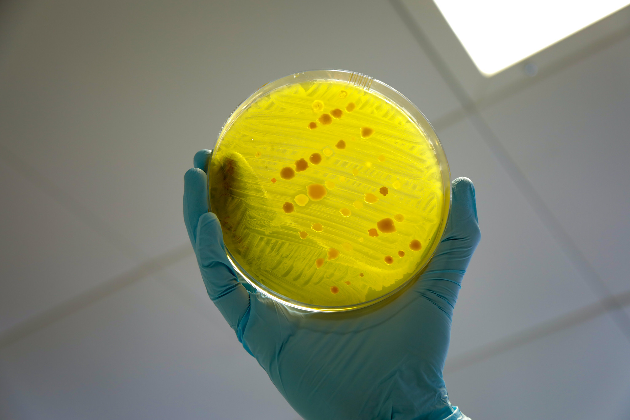 Per què la recent troballa d'un nou tipus d’antibiòtic t'afecta directament?
