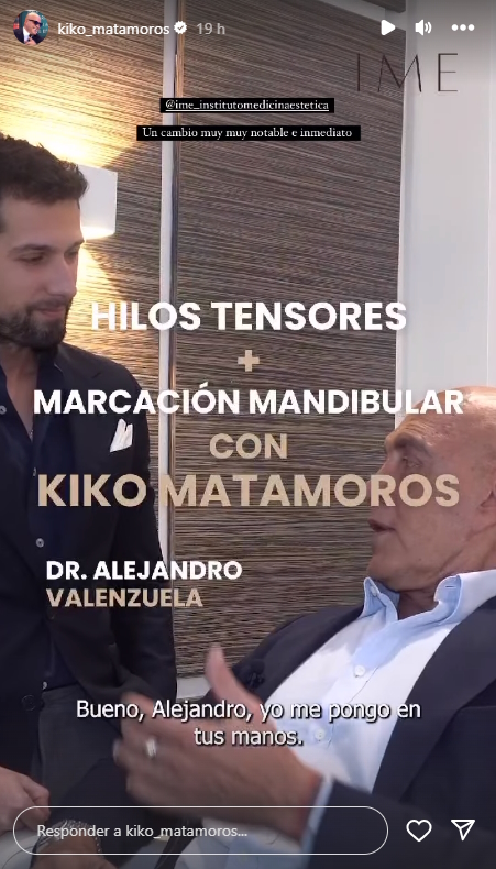 Kiko Matamoros lífting Insta Kiko Matamoros lífting Insta