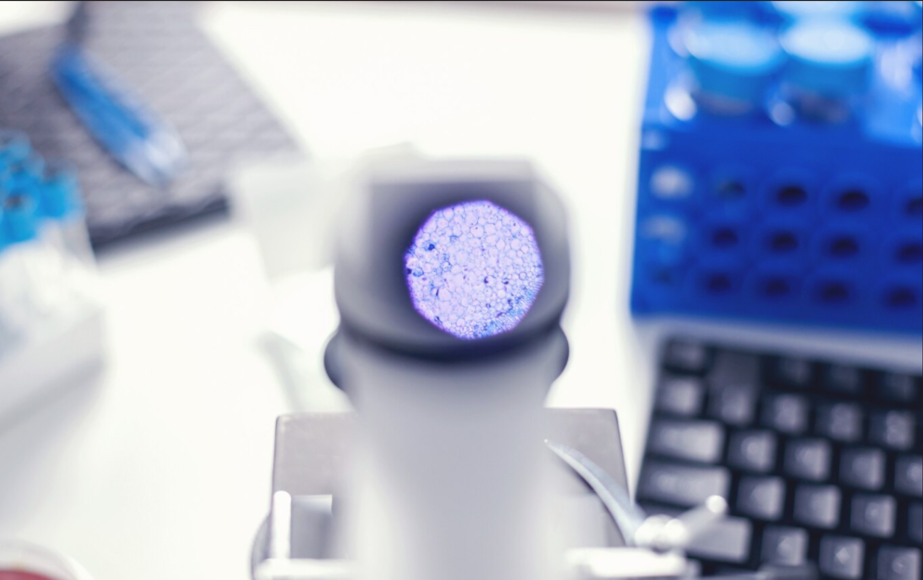 La tecnologia, la millor aliada en la detecció de càncer de pell