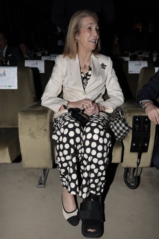 Infanta Elena pierna GTRES Infanta Elena pierna GTRES