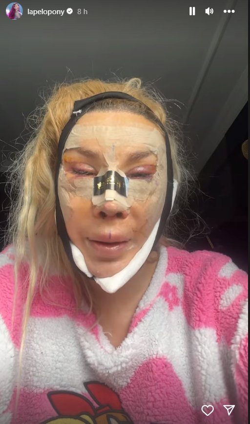 Pelopony despuesTurquia Instagram Pelopony despuesTurquia Instagram