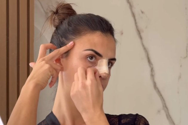 Sofia Suescun nariz insta Sofia Suescun nariz insta