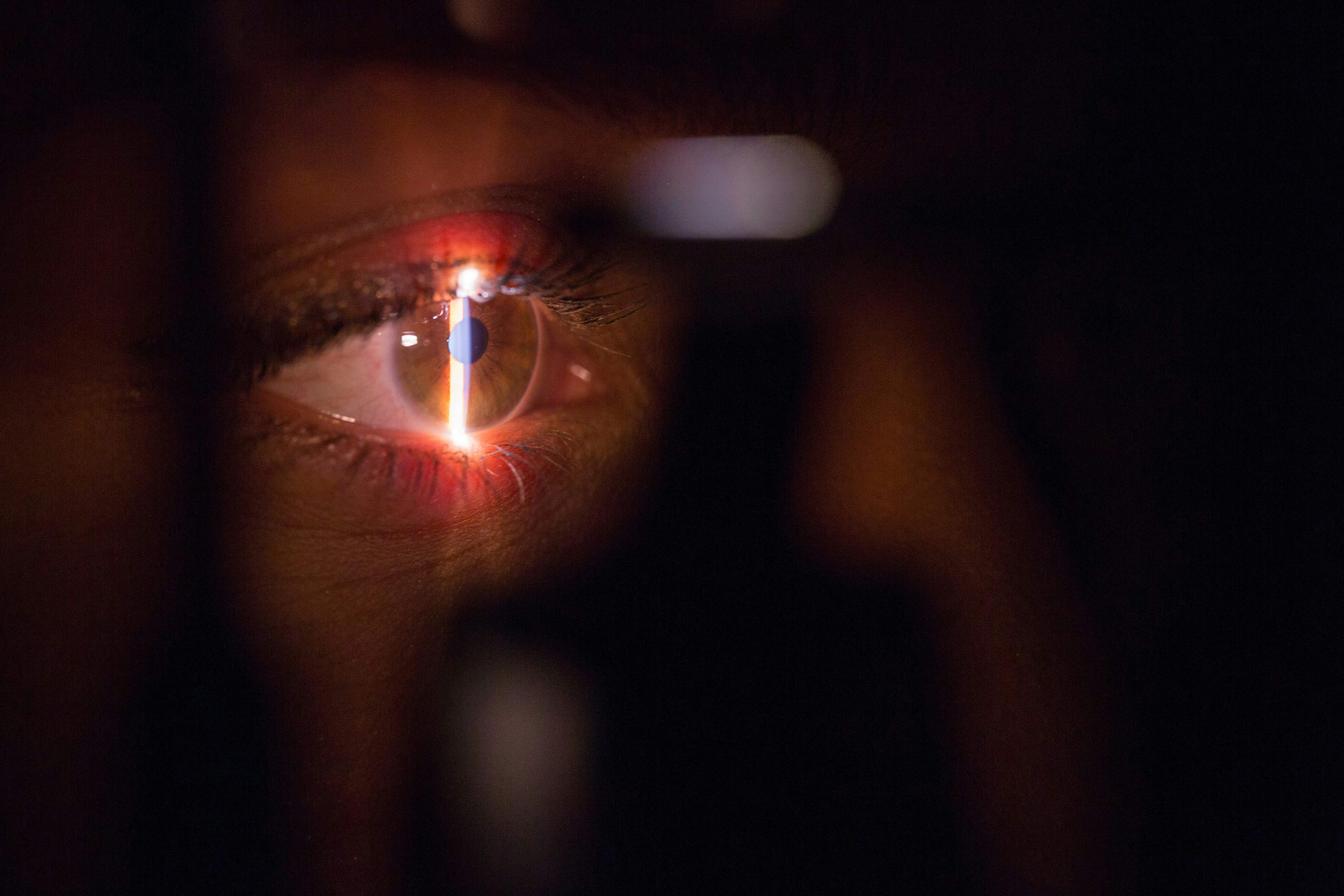 El nuevo negocio de OpenAI: largas colas para escanearse el iris a cambio de criptomonedas