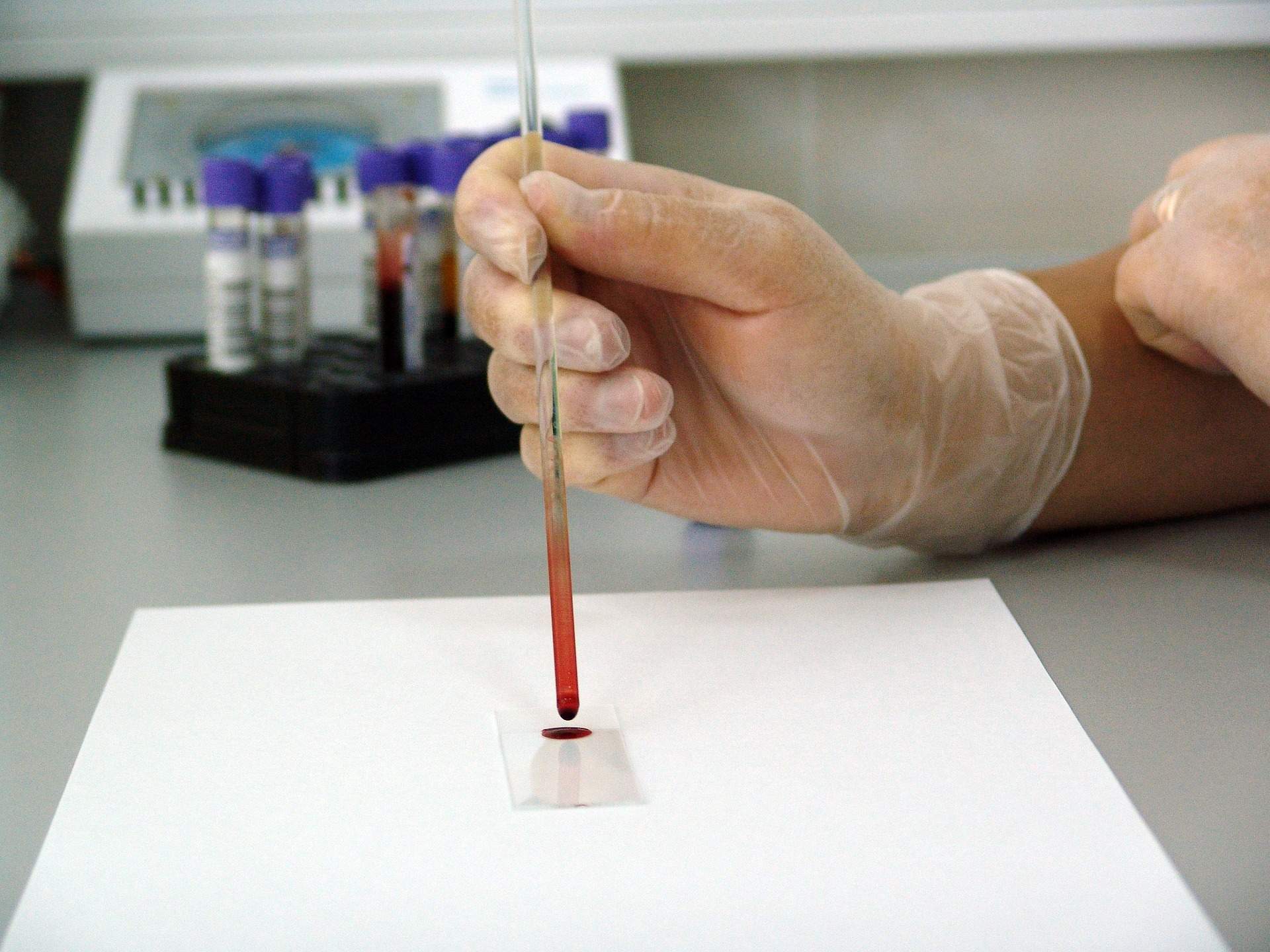Adeu a la colonoscòpia per detectar el càncer de còlon: un nou test el detecta de manera precoç