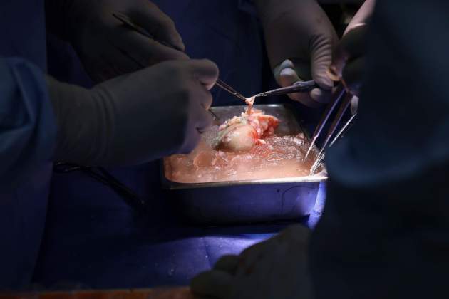 Cirurgians preparan legro cerdo por trasplante Hospital General Massachusetts