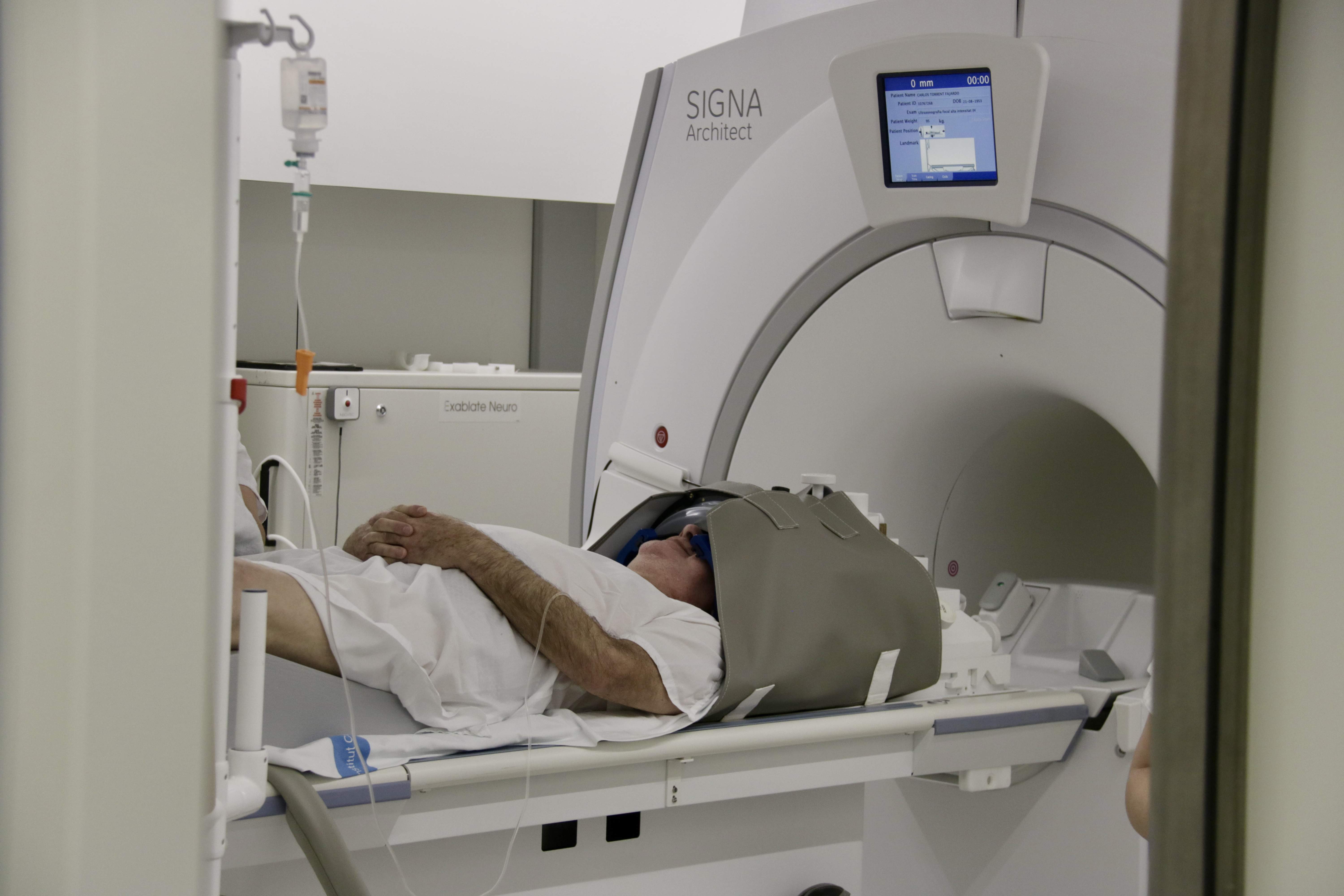 Can Ruti ha eliminat amb ultrasons fins a un 90% les tremolors per malalties com el Parkinson