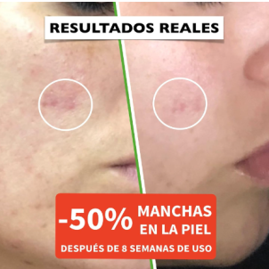 Difumina las manchas en la piel Difumina las manchas en la piel