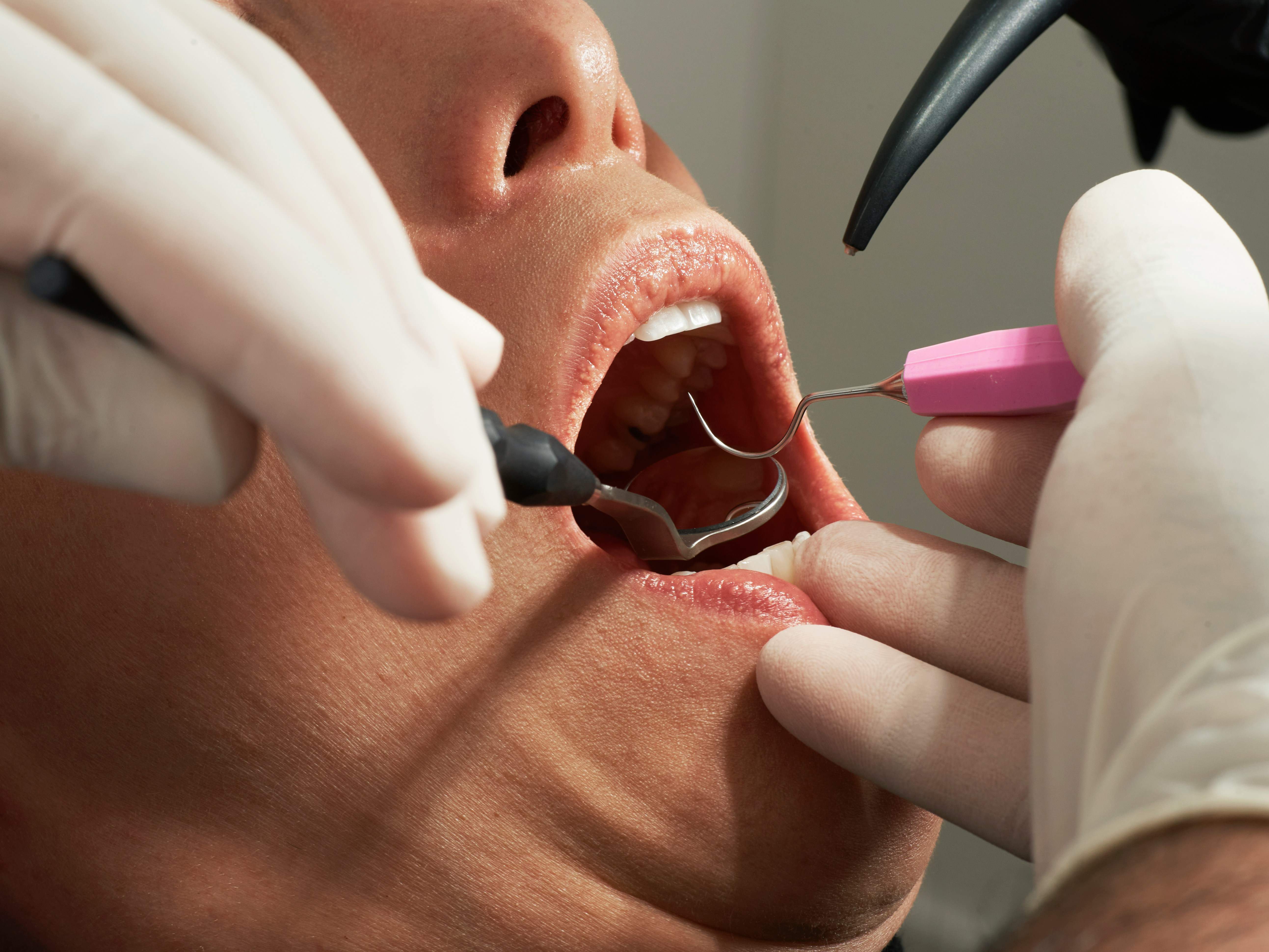 El 24% dels catalans renuncia al dentista i l’11% al psicòleg per no poder-ho pagar, segons Oxfam