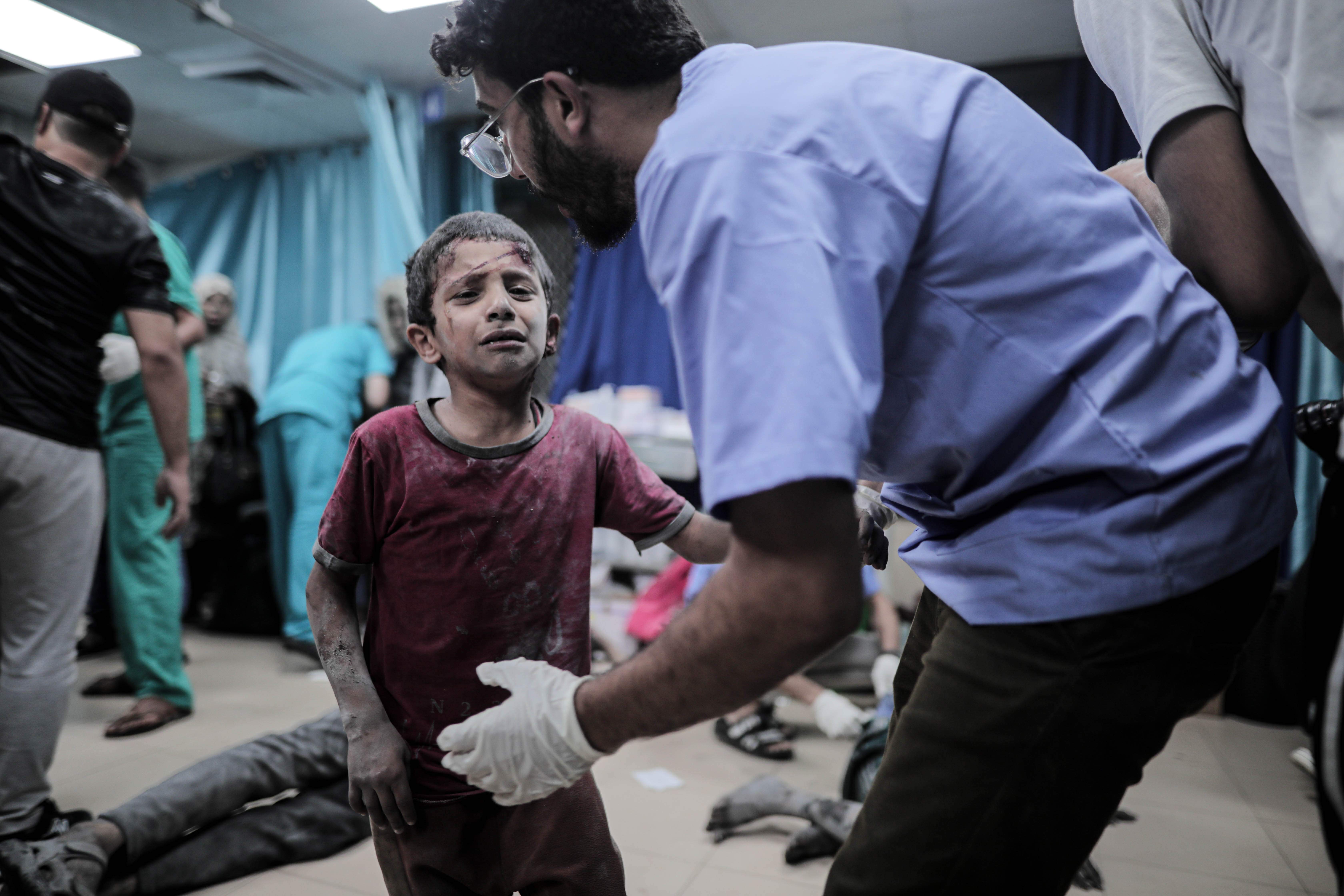 España acogerá a 30 niños de Gaza con cáncer o traumatismos para ser tratados