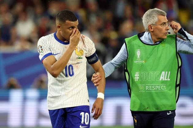 Mbappé nariz / Foto: EFE Mbappé nariz / Foto: EFE