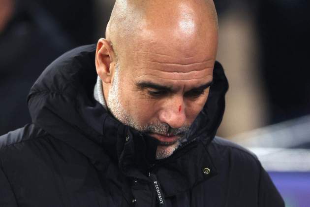Pep Guardiola ferides Manchester City EFE Pep Guardiola ferides Manchester City EFE