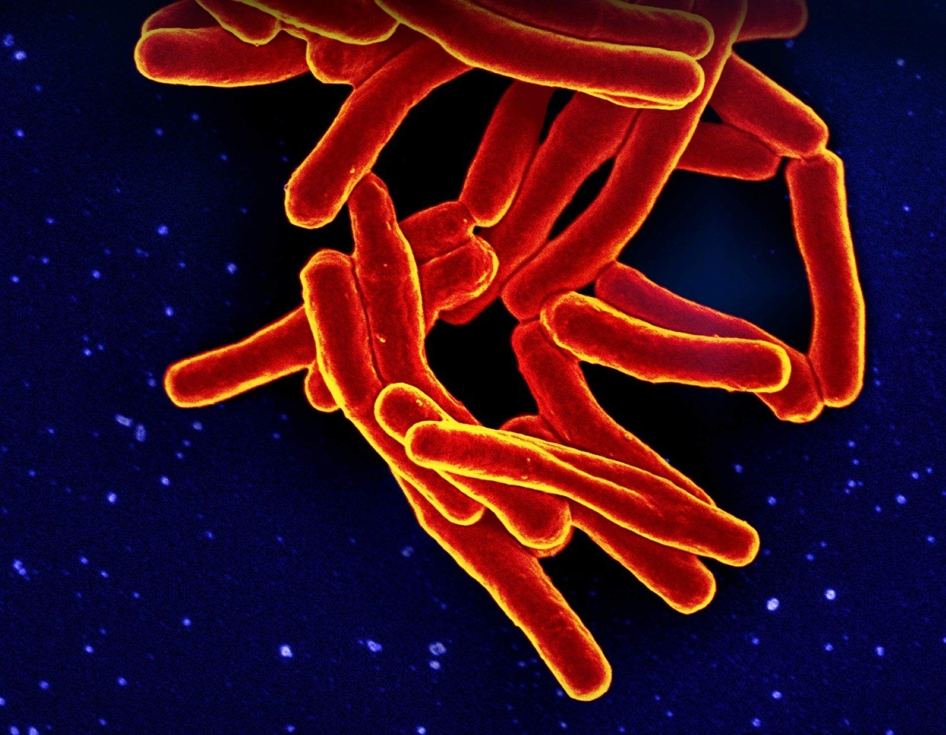 ¿La vida a la Tierra en riesgo? Alerta de los científicos para detener la investigación sobre bacterias espejo