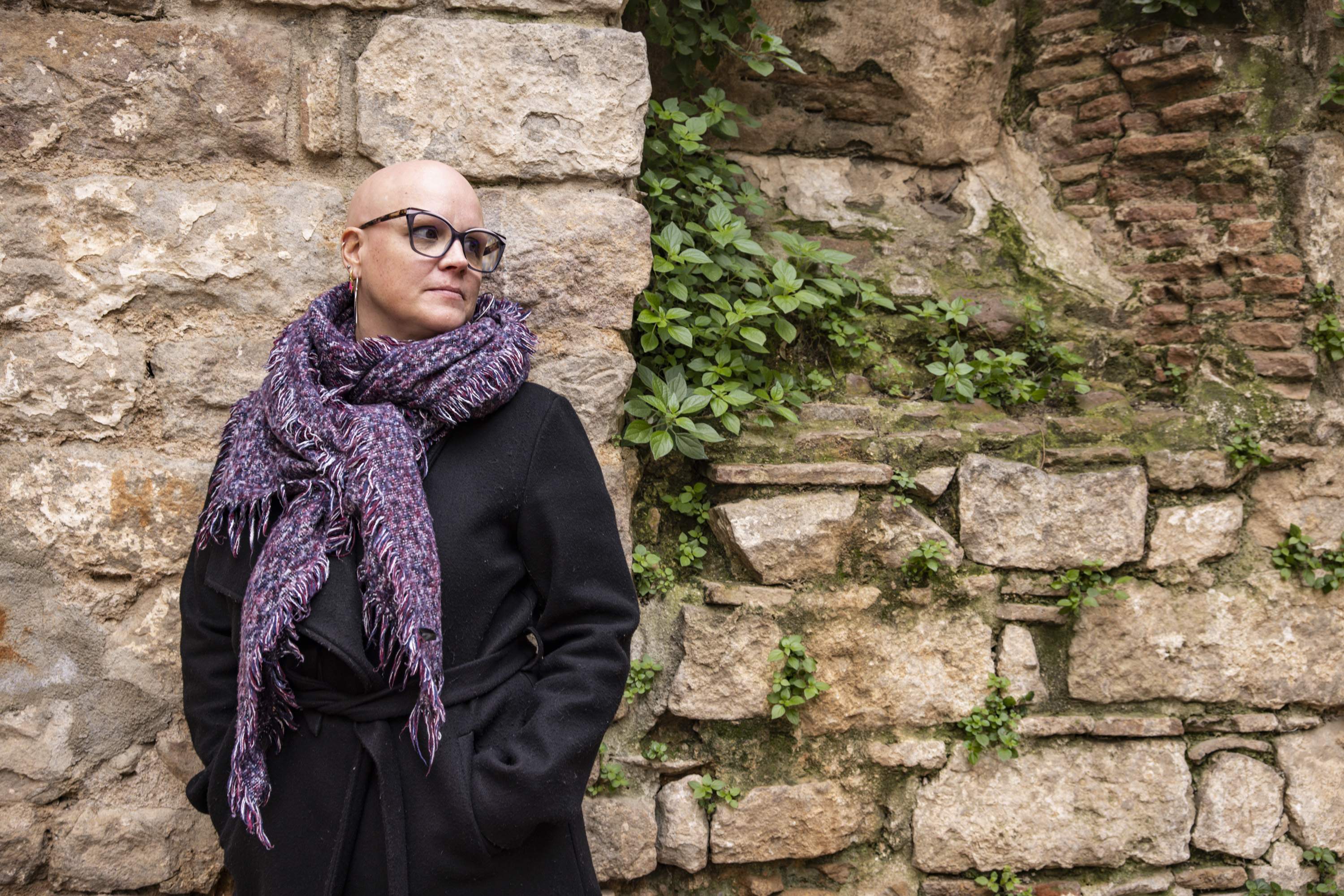 Alopecia femenina: "Hay muchas mujeres calvas, pero como no se ve normal, se esconde"