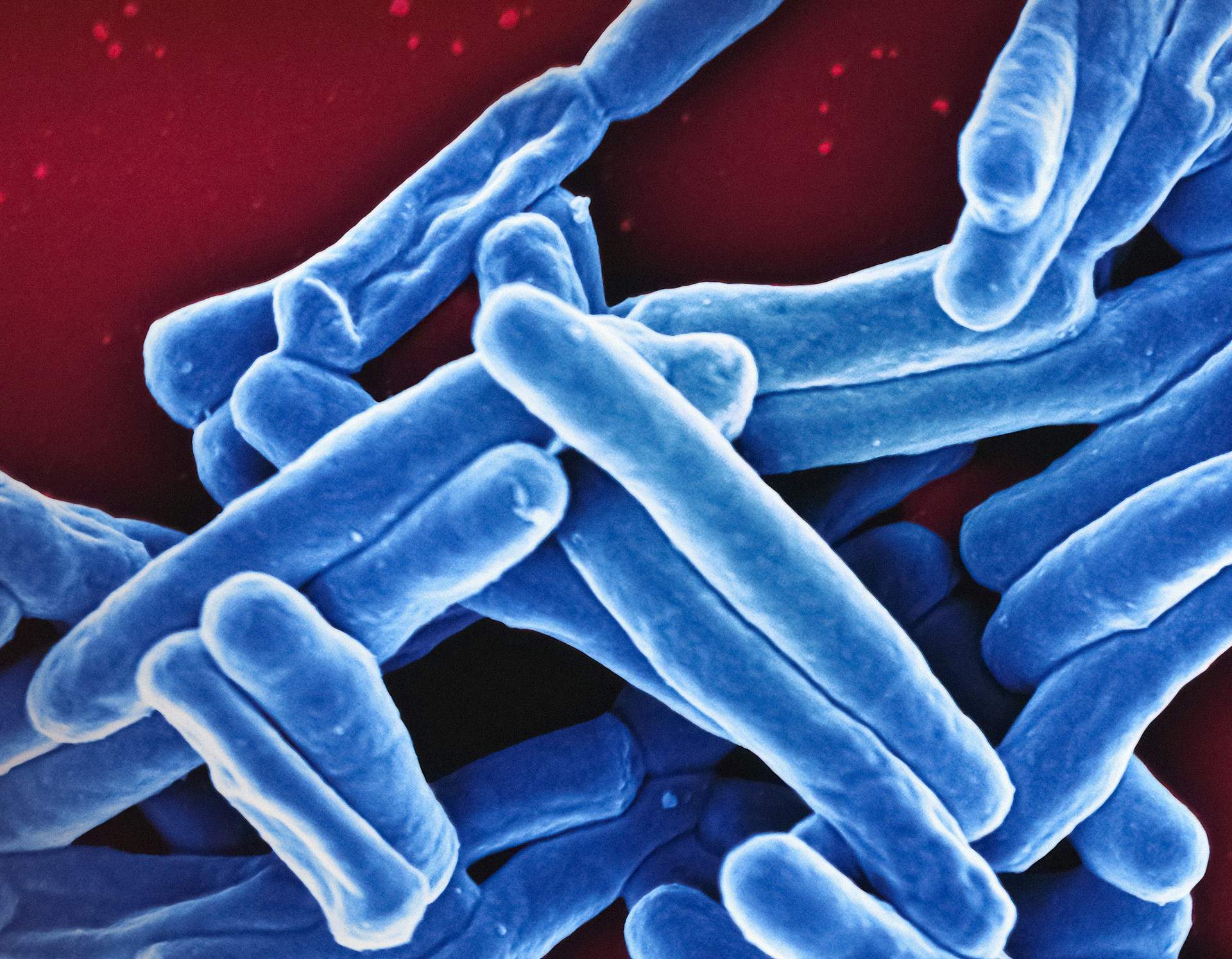 Un examen molecular de heces podría mejorar la detección de tuberculosis en adultos con VIH