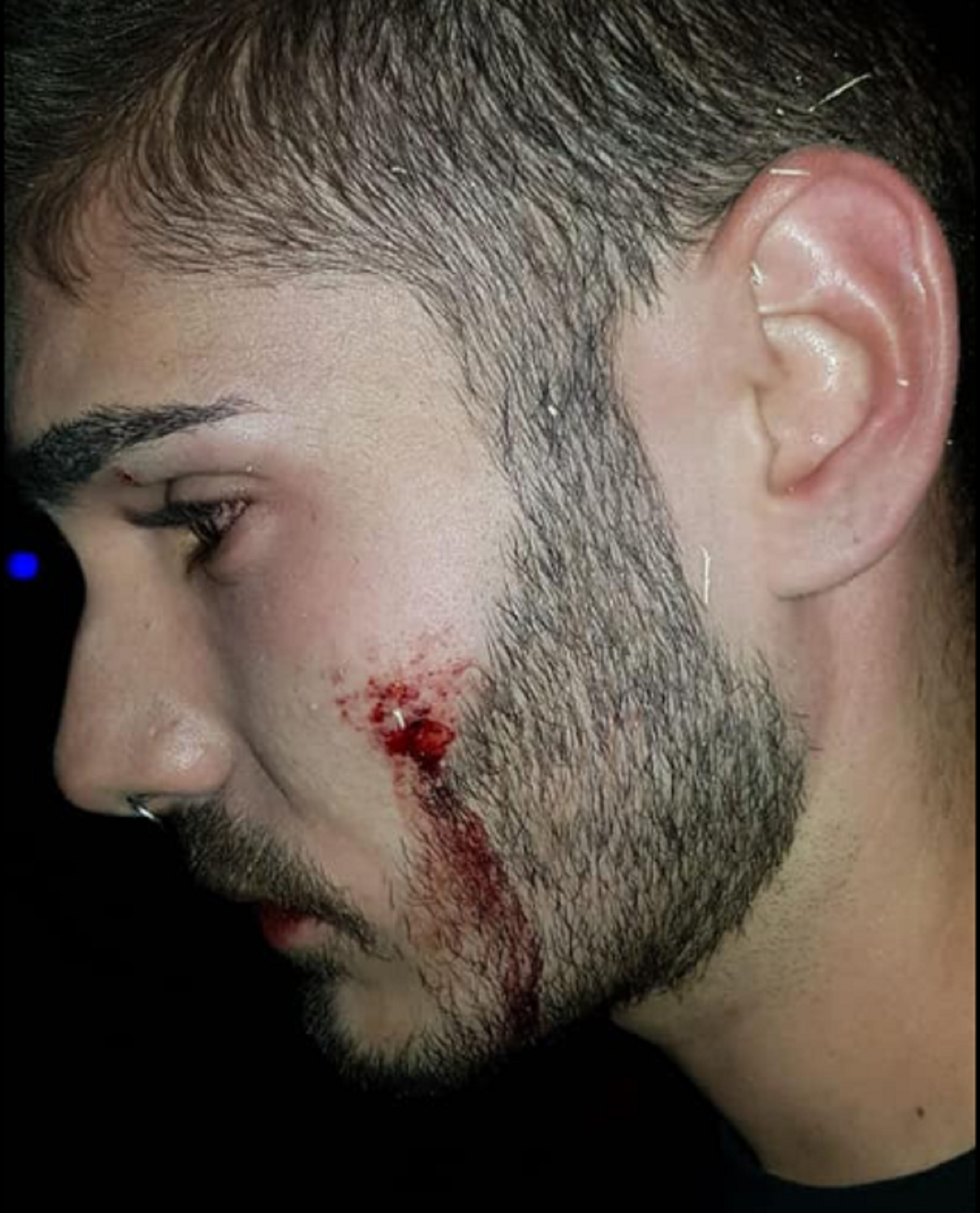 Denuncien una agressió homòfoba a una discoteca d'Alarcón