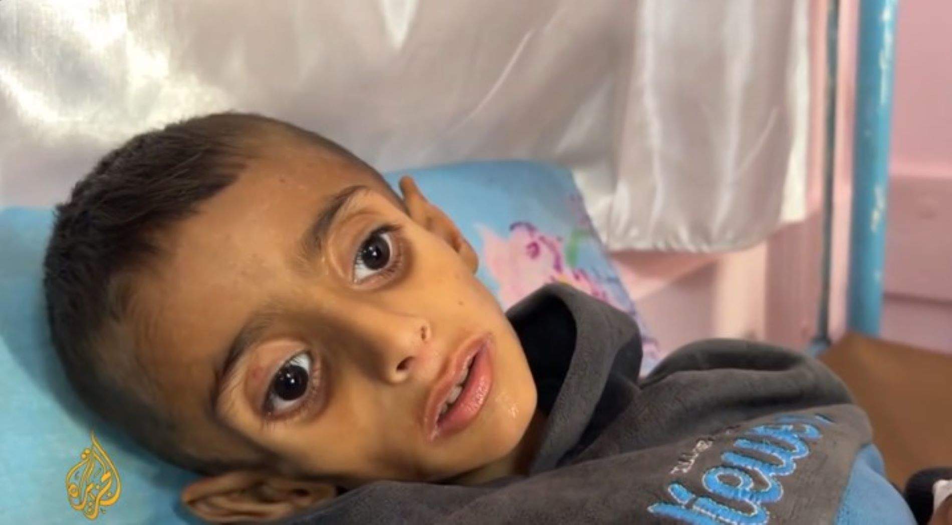 Miseria extrema en Gaza: miles de niños sufren desnutrición por la falta de alimentos en el territorio