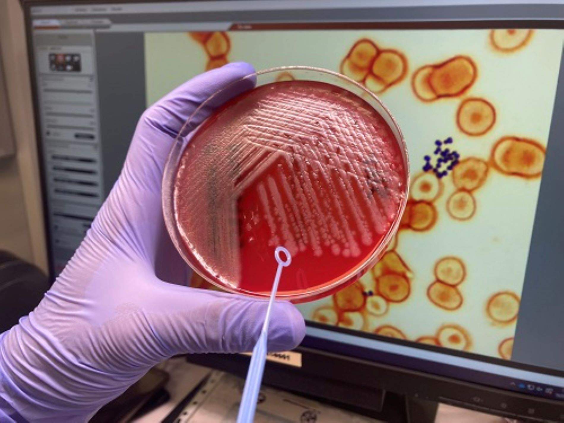 Gran avance catalán contra las bacterias resistentes a los antibióticos