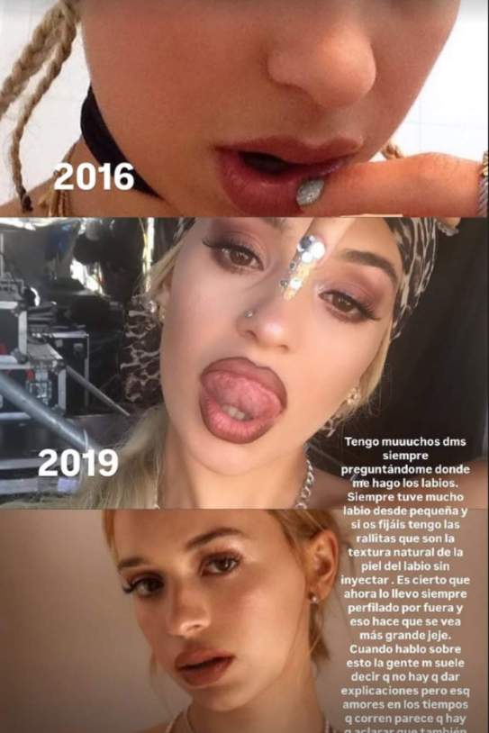 Bad Gyal sobre els seus llavis Instagram (1) Bad Gyal sobre els seus llavis Instagram (1)