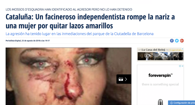 Imatge falsa attacked woman