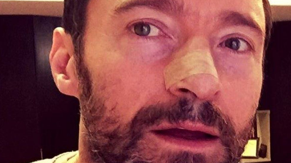 hugh jackman