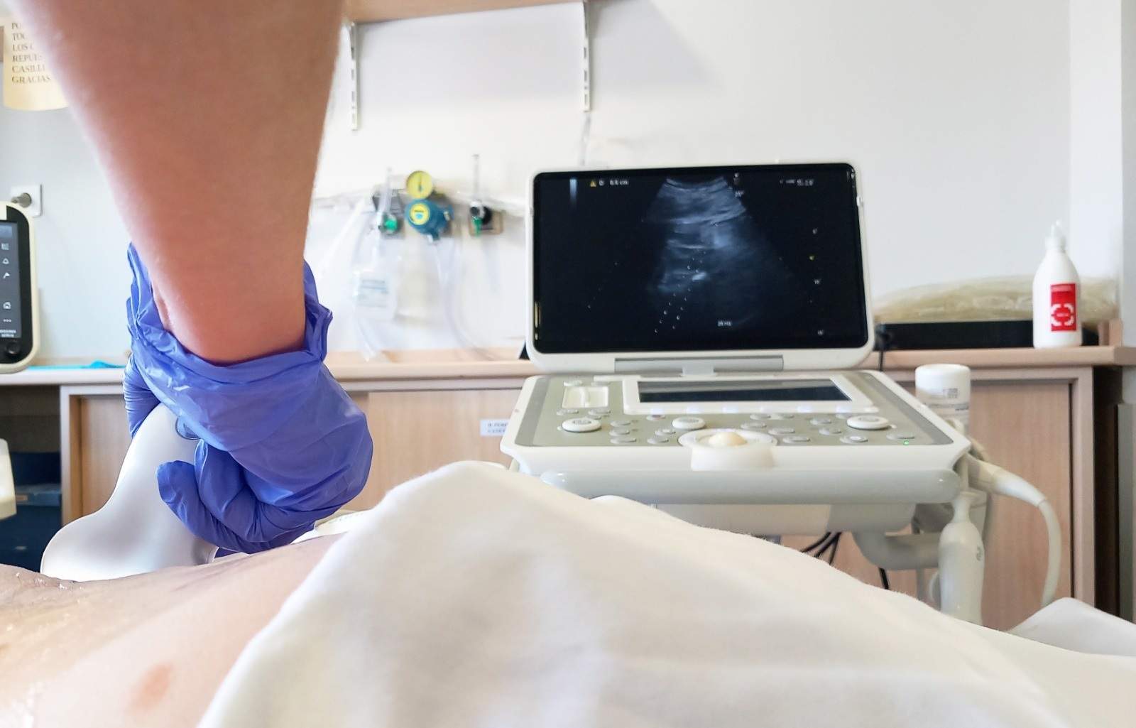 Una nova estratègia terapèutica duplica la supervivència en el càncer de còlon de pitjor pronòstic