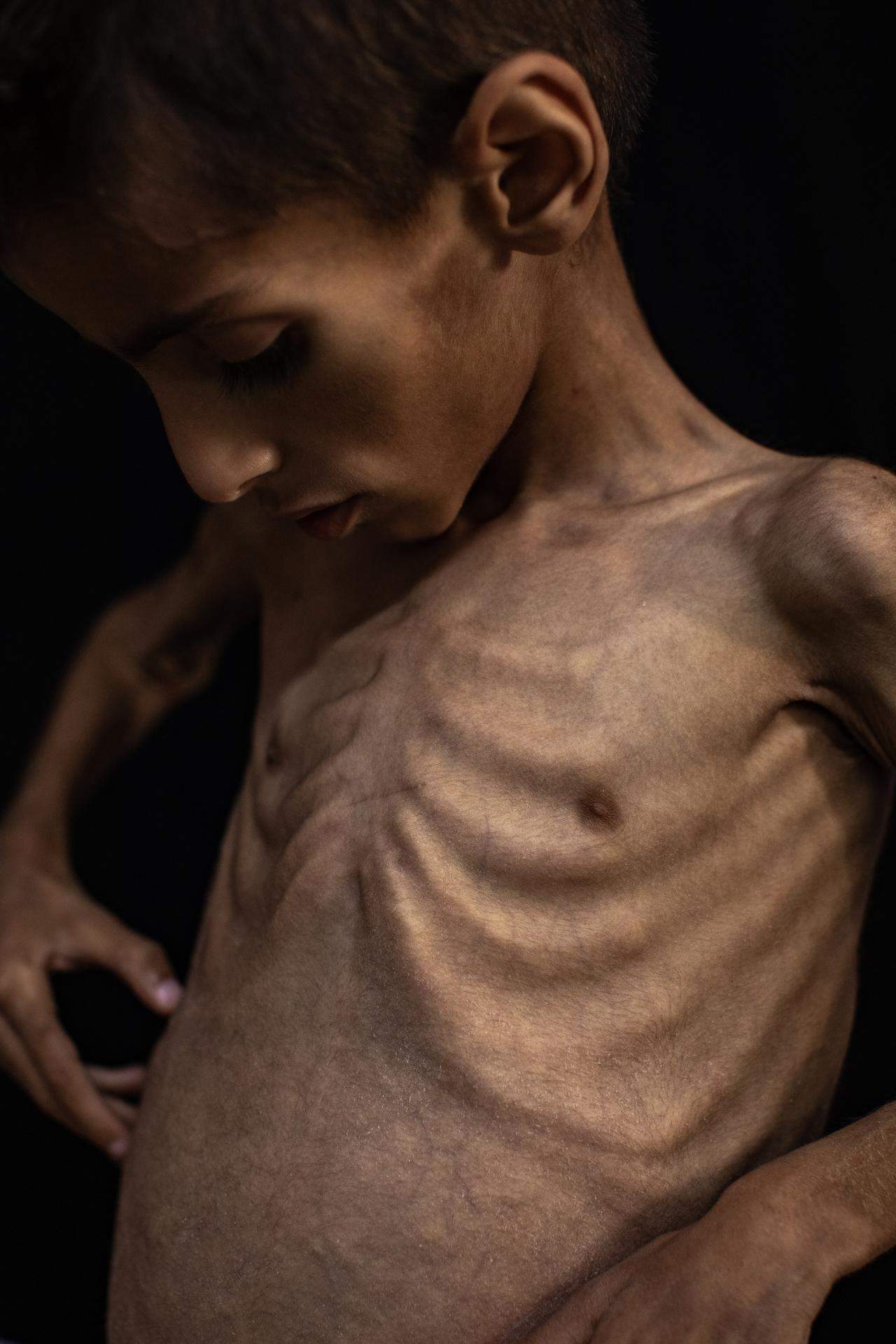 gaza hambre efe (2) gaza hambre efe (2)