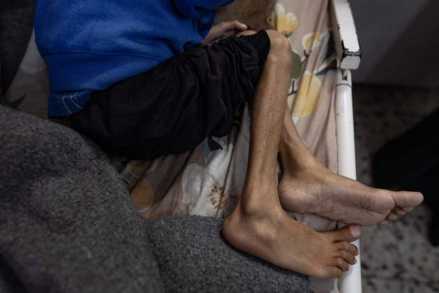 gaza efe hambre gaza efe hambre