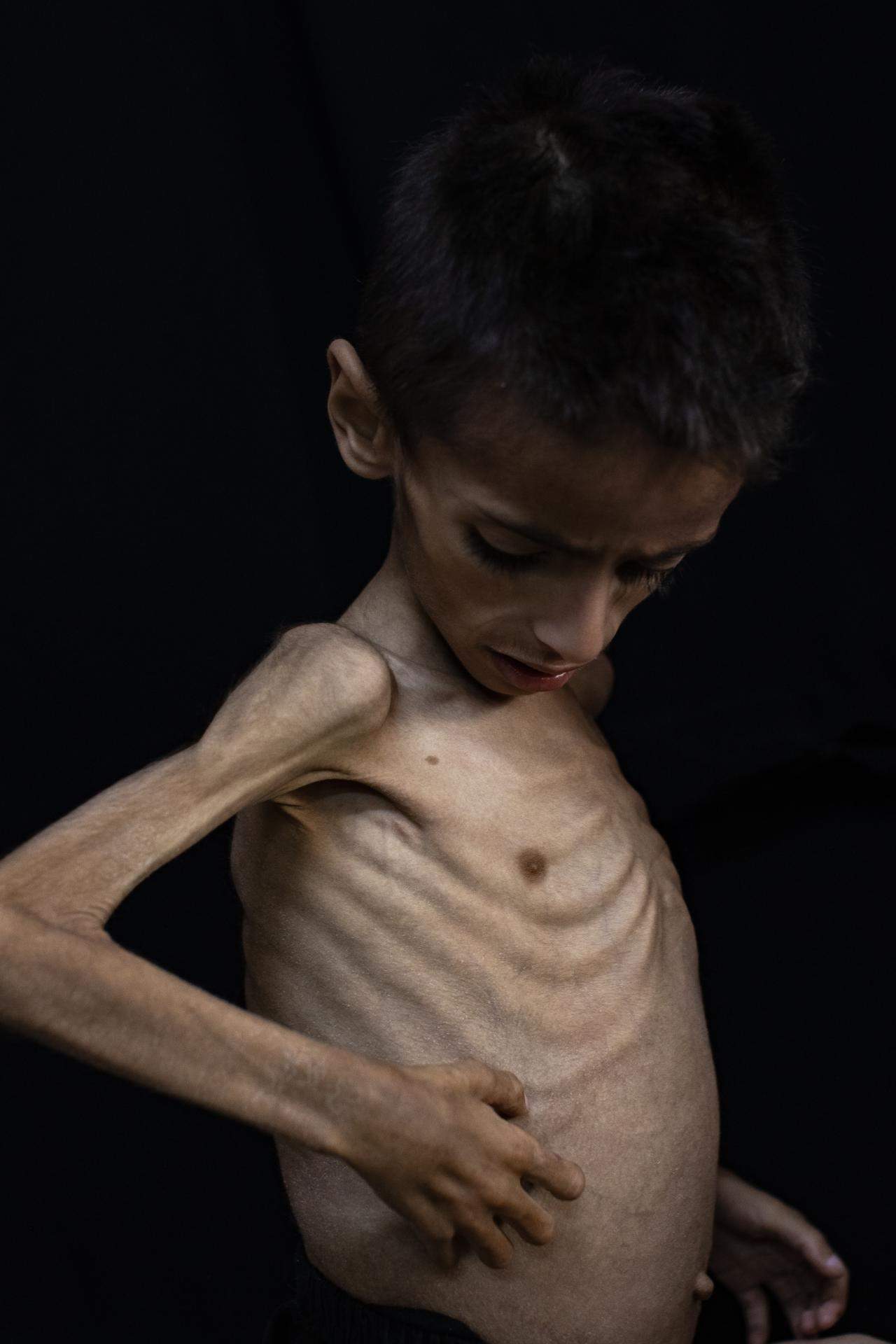 gaza hambre efe gaza hambre efe