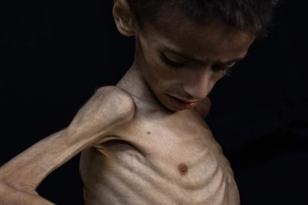 gaza hambre efe gaza hambre efe